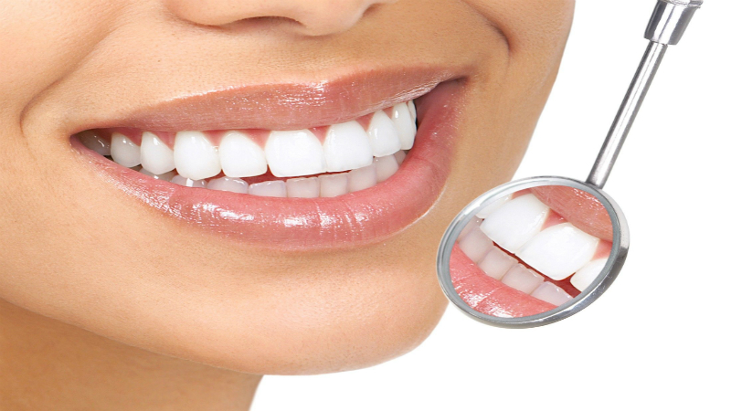 Teeth Whitening in Macon, GA Can Make That Smile Shine